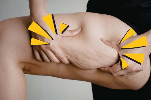 homemade recipes for cellulite