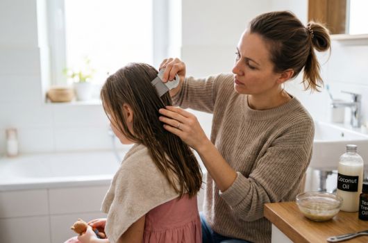 home remedies for lice
